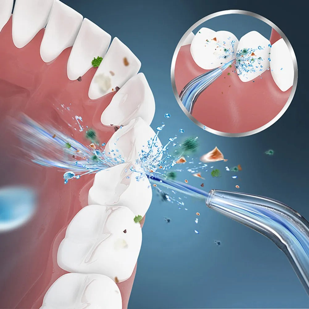 Irrigador oral portatil 🦷✨